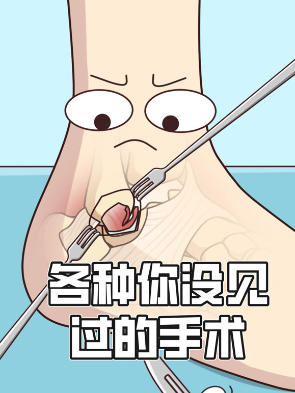 各种你没见过的手术